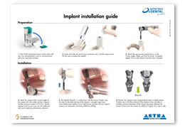 Implant installation guide